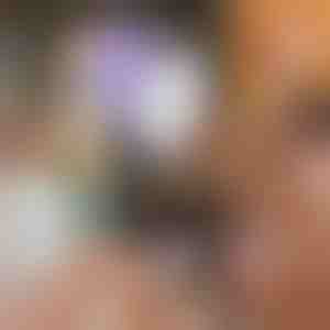 Solución indolora para la eliminación del vello | SILKSKIN